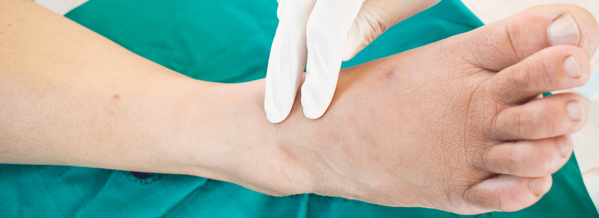 Diabetic foot care at home,🔺daily routine!