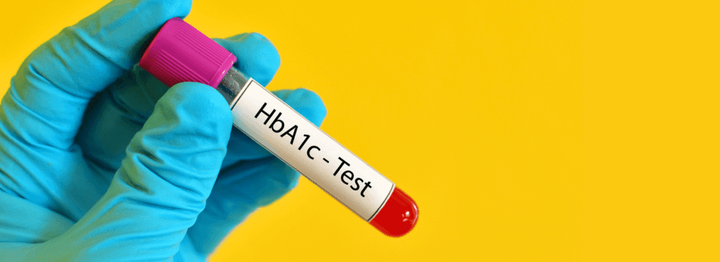 🔍 ¿qué es lo que indica la prueba hba1c sobre tu nivel de azúcar en la sangre? 🩸🕒 - -